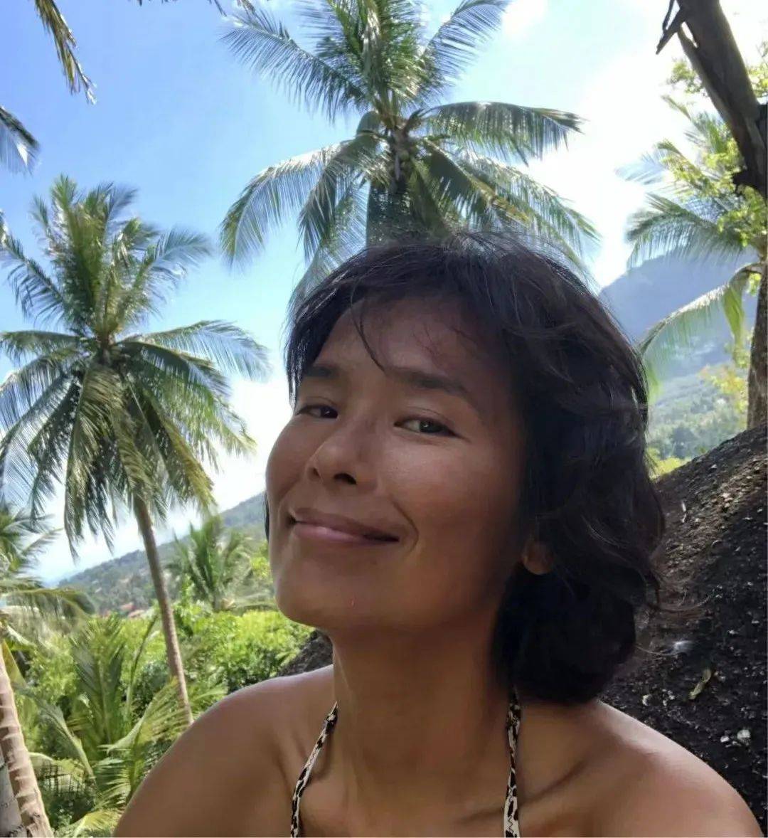 著名歌星自曝遭遇重大车祸,整个脊柱断了!